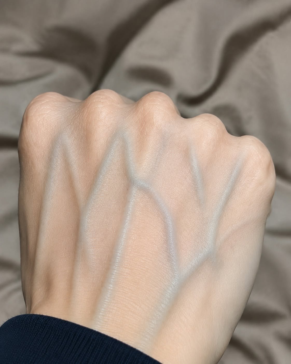 If your veins are visible in your hand, it is a signal of ca…See more