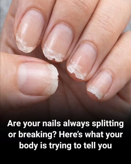 Brittle Nails …Your Body May Be Trying to Tell You Something Important