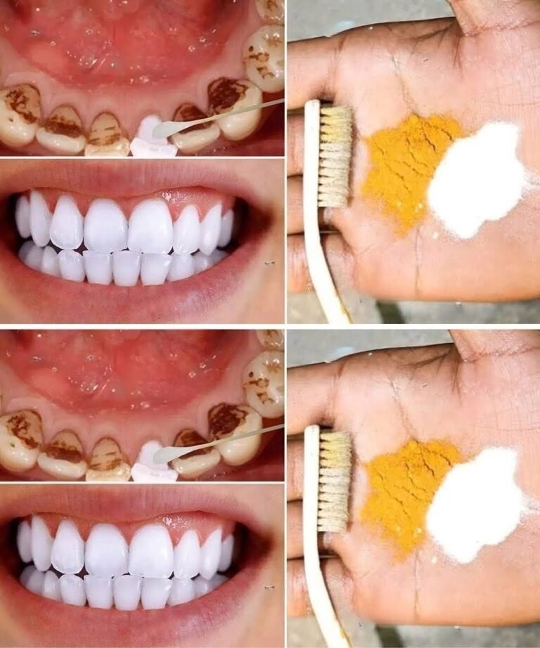 Home Teeth Whitening: Get Whiter Teeth in Just 2 Minutes!