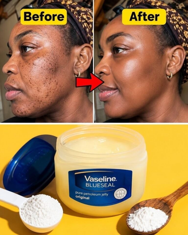 How to remove skin tags naturally at home overnight: the best method with petroleum jelly.