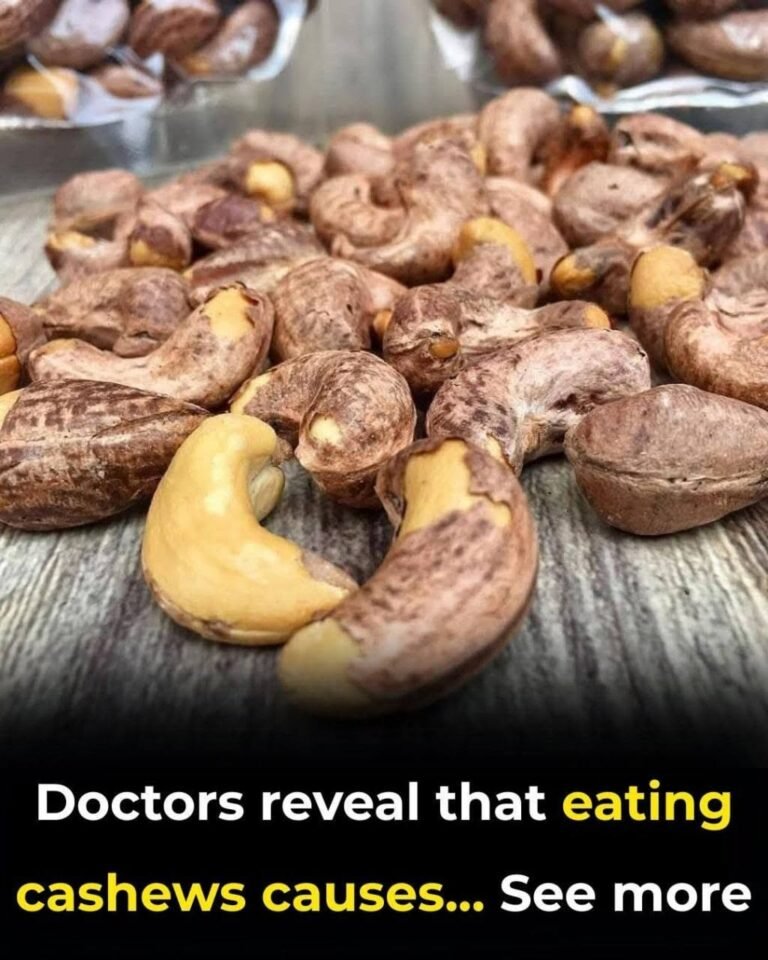 Doctors reveal that eating cashews causes .