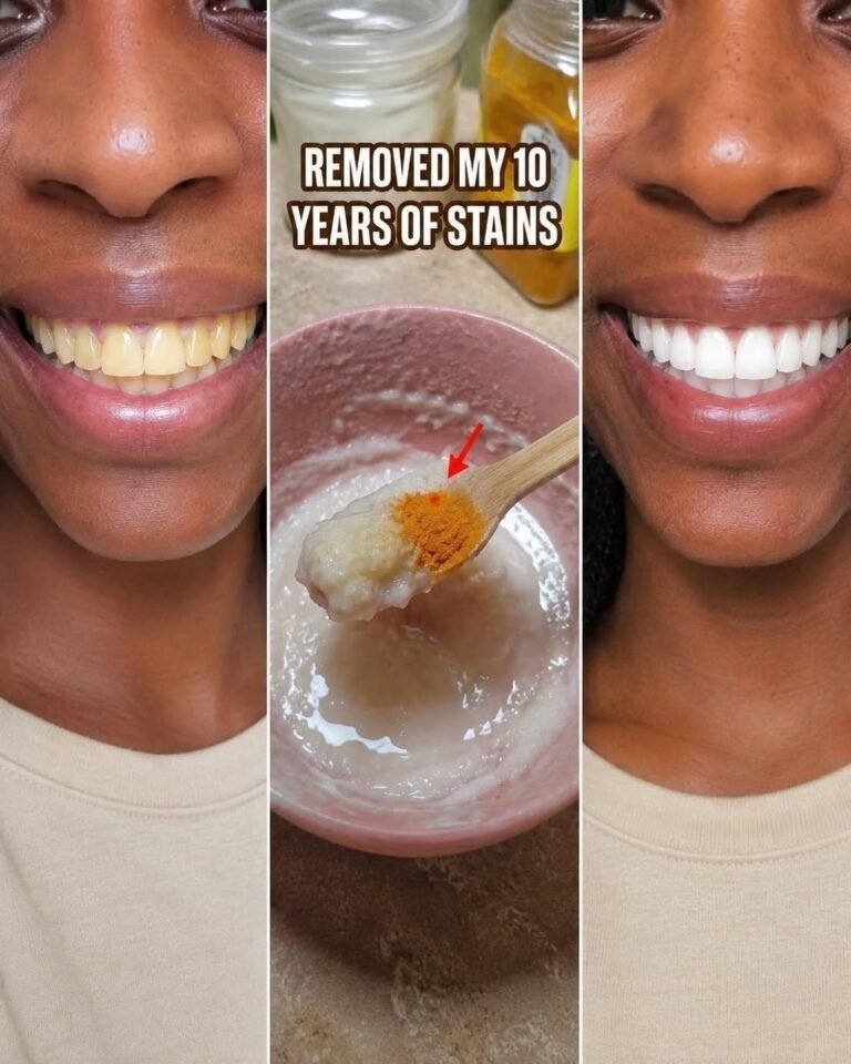 in two minutes remove 10 years of stains from teeth Results will Shock You