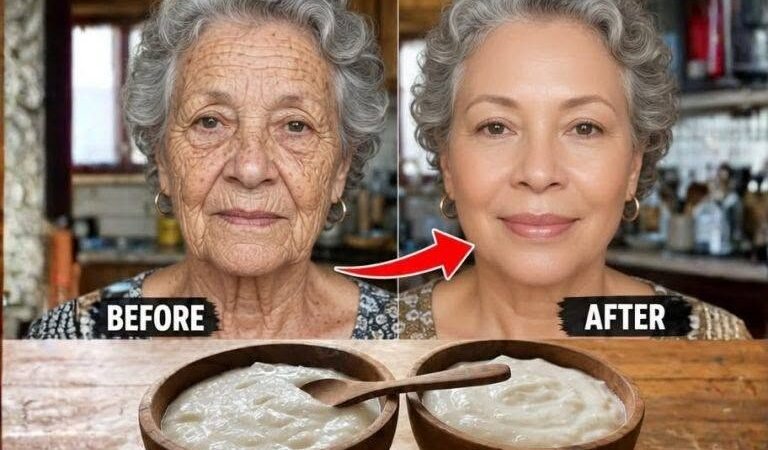 Prepare a baking soda cream and apply it before sleeping. Goodbye to wrinkles and spots…