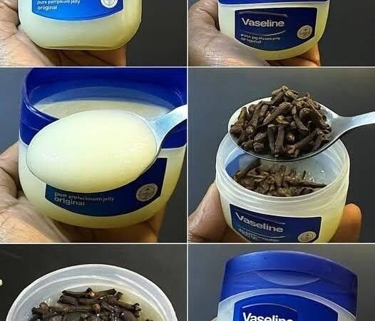 Mix cloves with petroleum jelly: a secret no one will ever tell you. Thank me later.