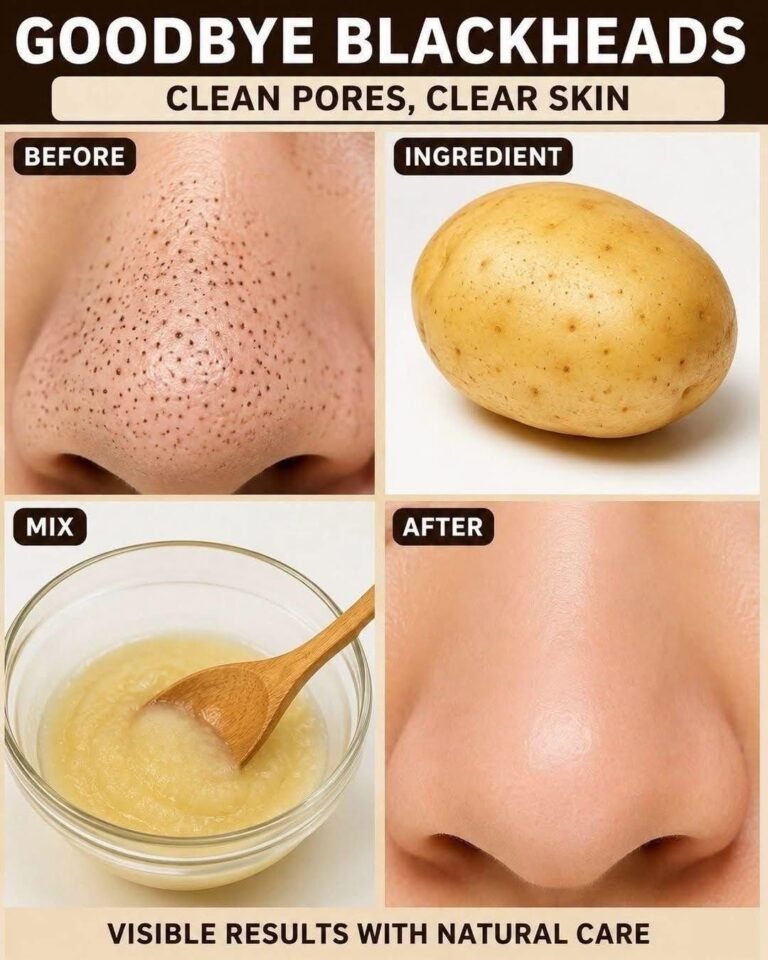 Potato for Blackheads? This Simple One-Ingredient Idea May Surprise You